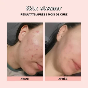 Skincleaner_3